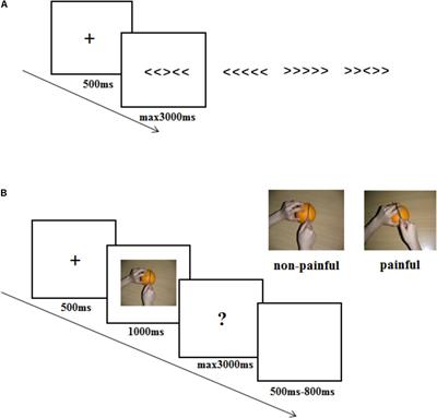 Competitive Intensity Modulates the Pain Empathy Response: An Event-Related Potentials Study